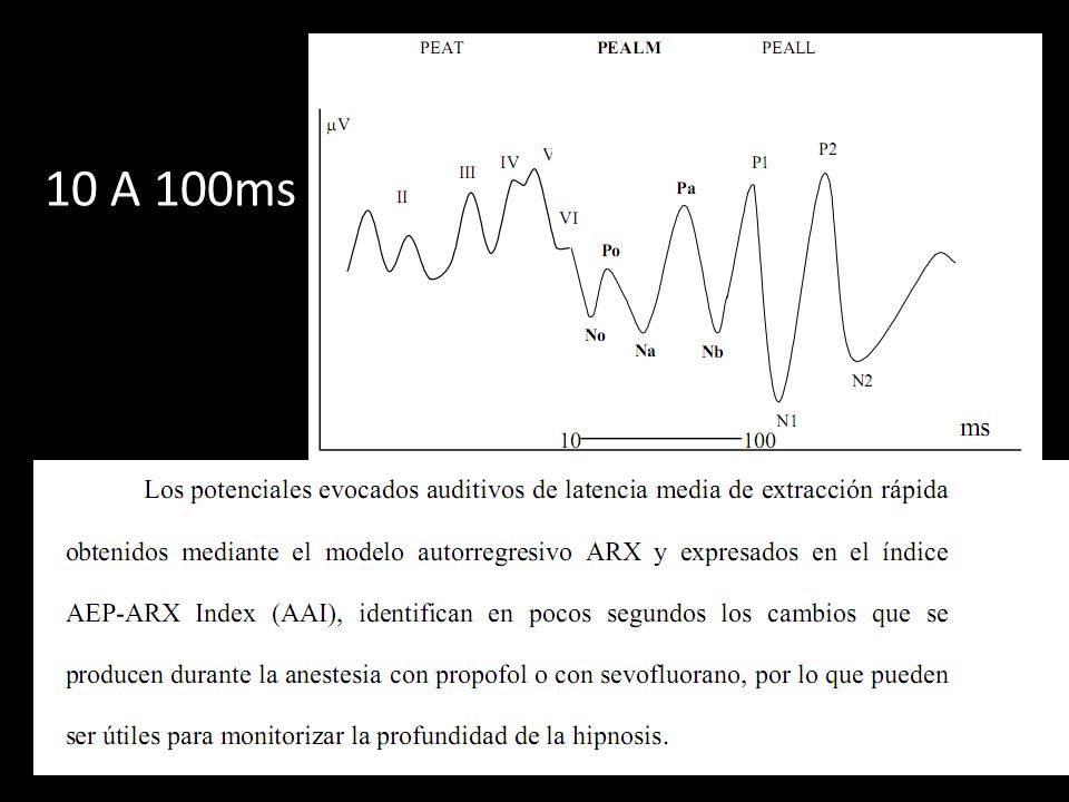10 A 100ms COMPARADOS CON 15 SEGPARA CSI, DE 30 SEG DE BIS Y 65 SEG DE NARCOTREND.