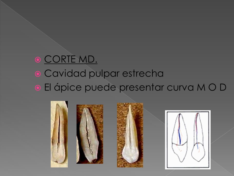 CORTE MD. Cavidad pulpar estrecha El ápice puede presentar curva M O D