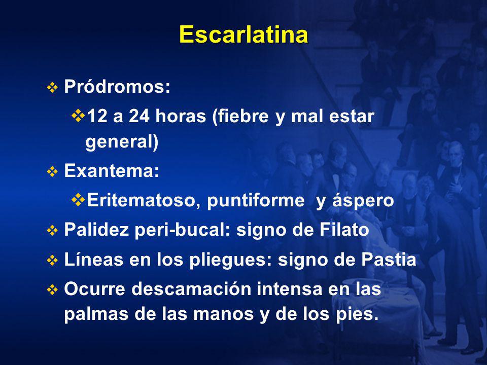 Escarlatina Pródromos: 12 a 24 horas (fiebre y mal estar general)