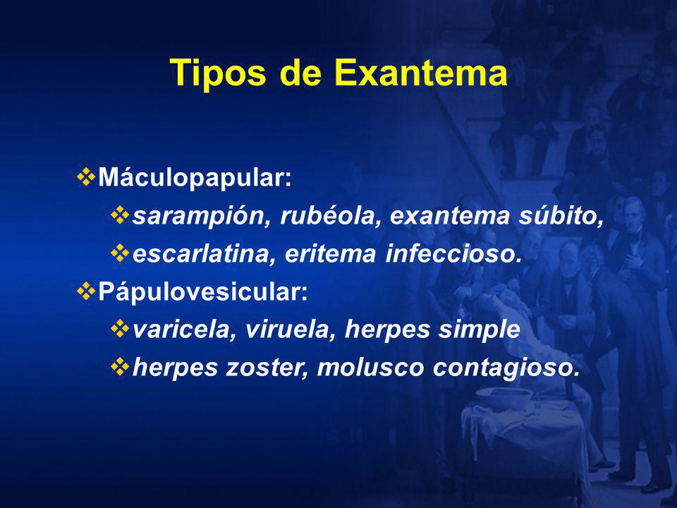 Tipos de Exantema Máculopapular: sarampión, rubéola, exantema súbito,