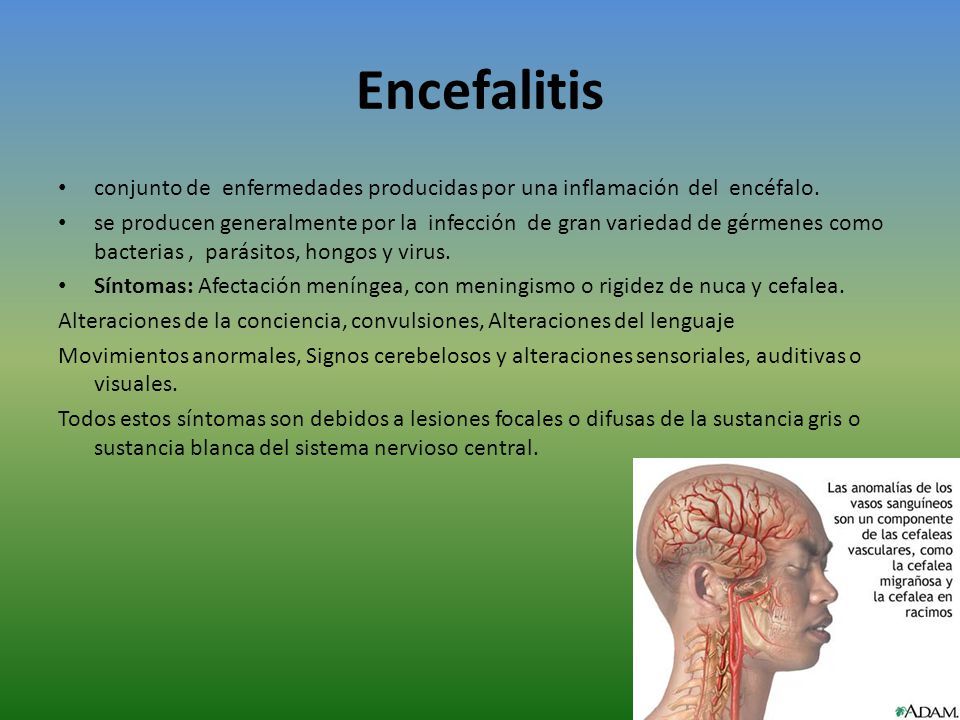 Encefalitis conjunto de enfermedades producidas por una inflamación del encéfalo.