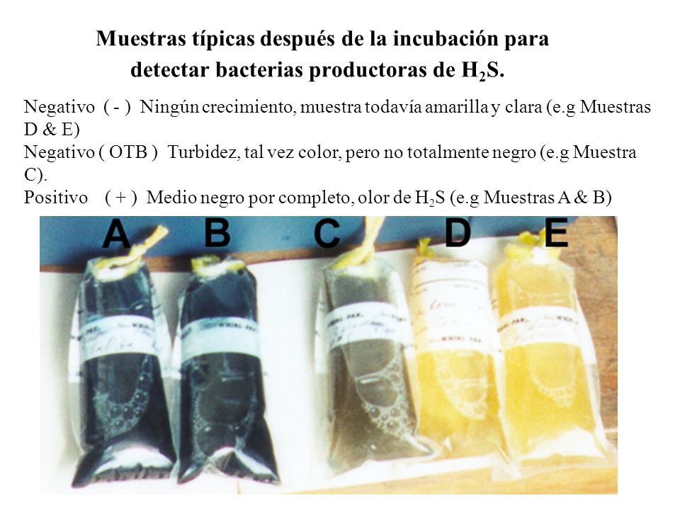 Muestras típicas después de la incubación para detectar bacterias productoras de H2S.