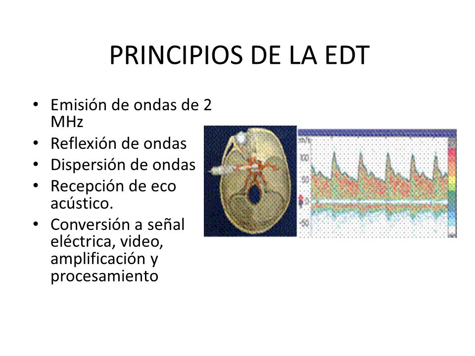 PRINCIPIOS DE LA EDT Emisión de ondas de 2 MHz Reflexión de ondas