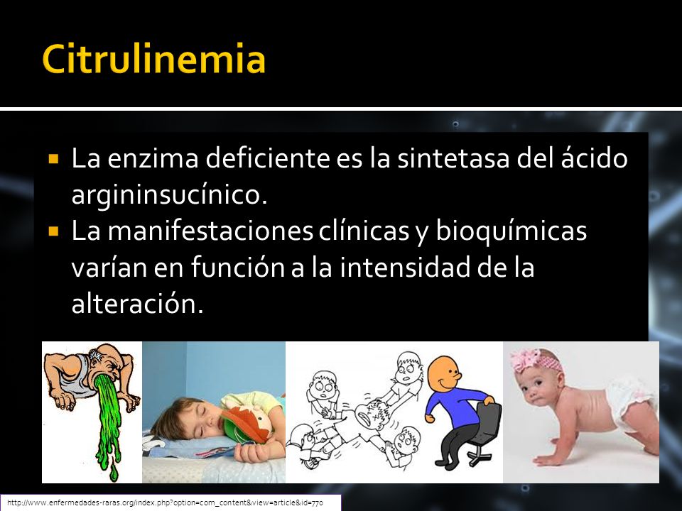 Citrulinemia La enzima deficiente es la sintetasa del ácido argininsucínico.