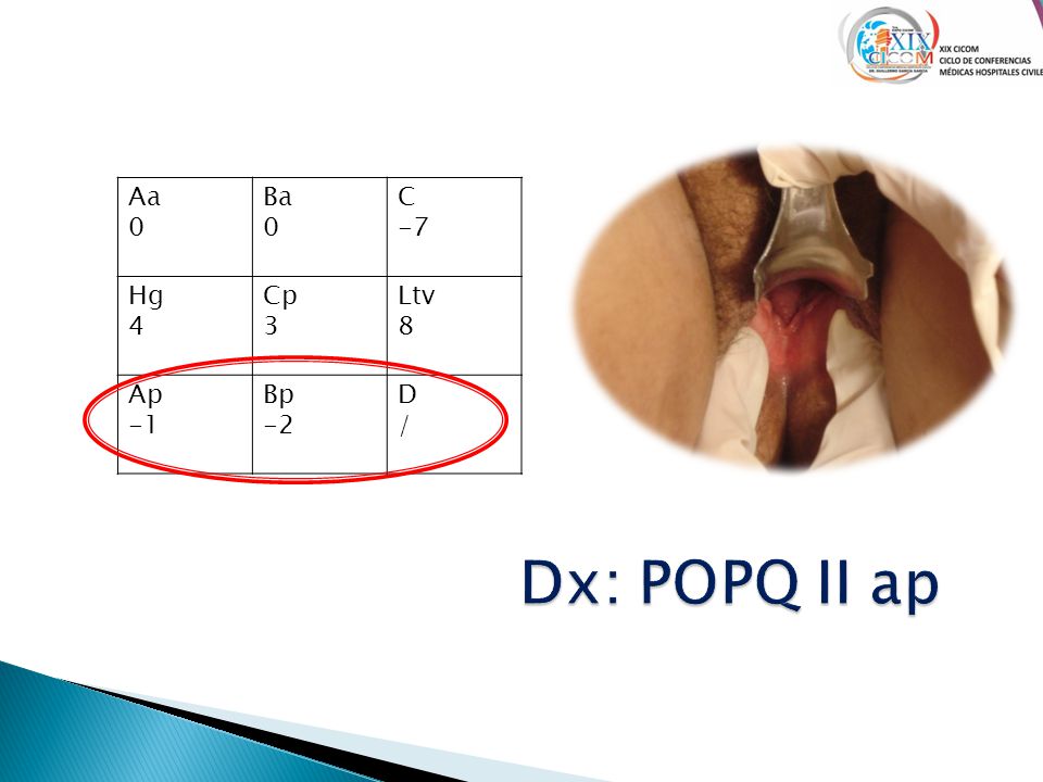 Aa 0 Ba 0. C -7. Hg 4. Cp 3. Ltv 8.