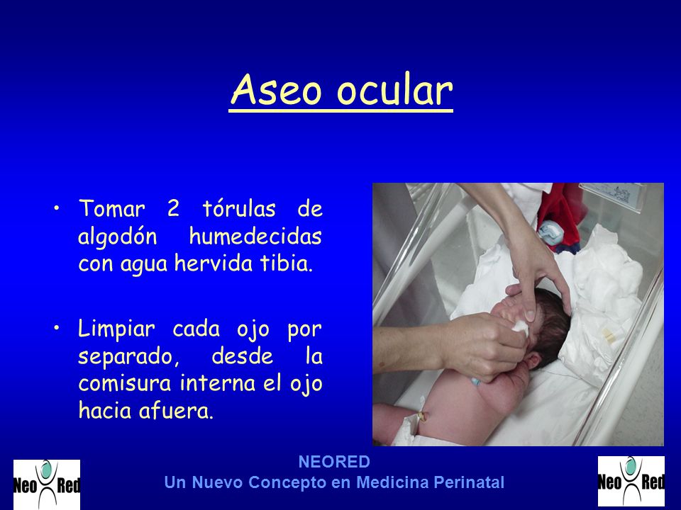 Aseo ocular Tomar 2 tórulas de algodón humedecidas con agua hervida tibia.