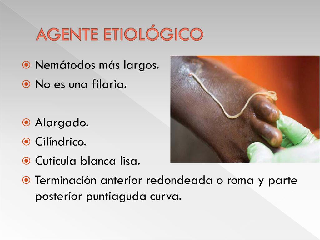 AGENTE ETIOLÓGICO Nemátodos más largos. No es una filaria. Alargado.