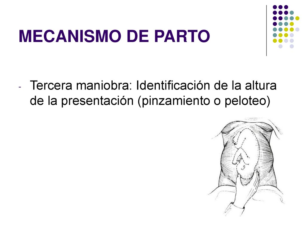 MECANISMO DE PARTO Tercera maniobra: Identificación de la altura de la presentación (pinzamiento o peloteo)