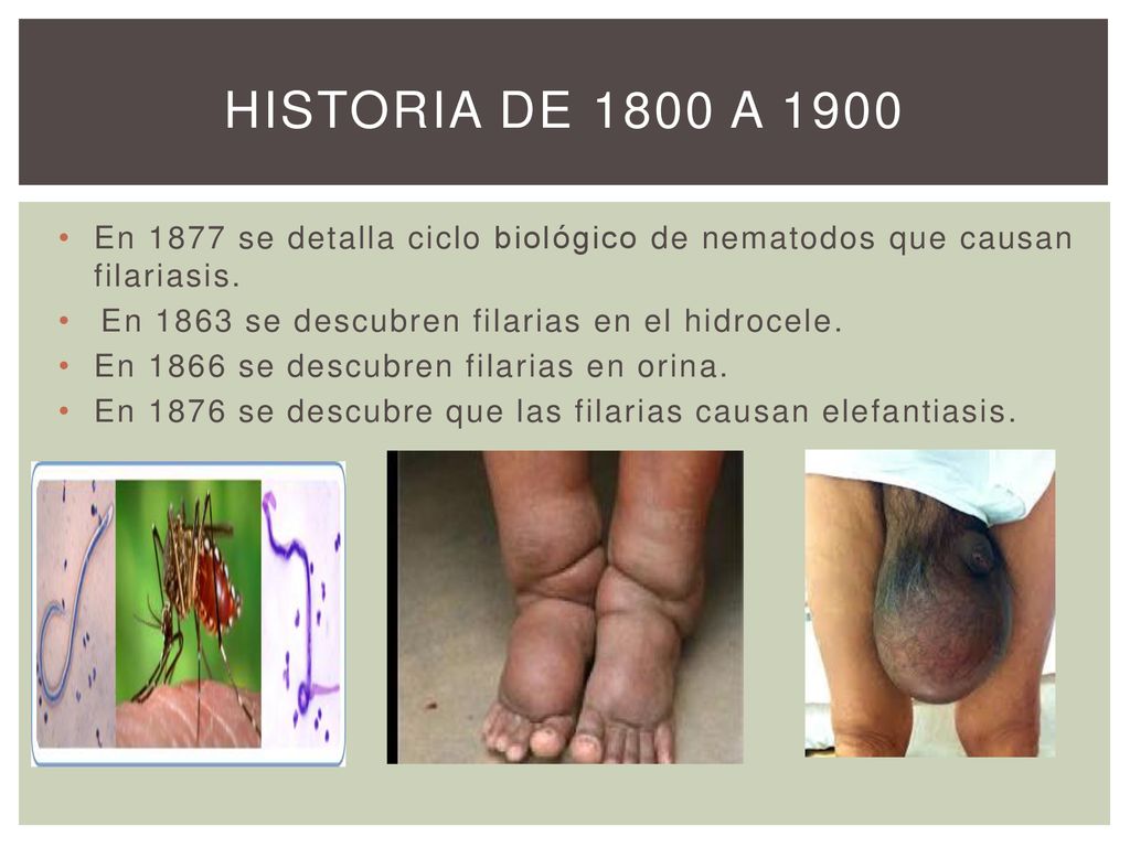 HISTORIA DE 1800 A 1900 En 1877 se detalla ciclo biológico de nematodos que causan filariasis. En 1863 se descubren filarias en el hidrocele.
