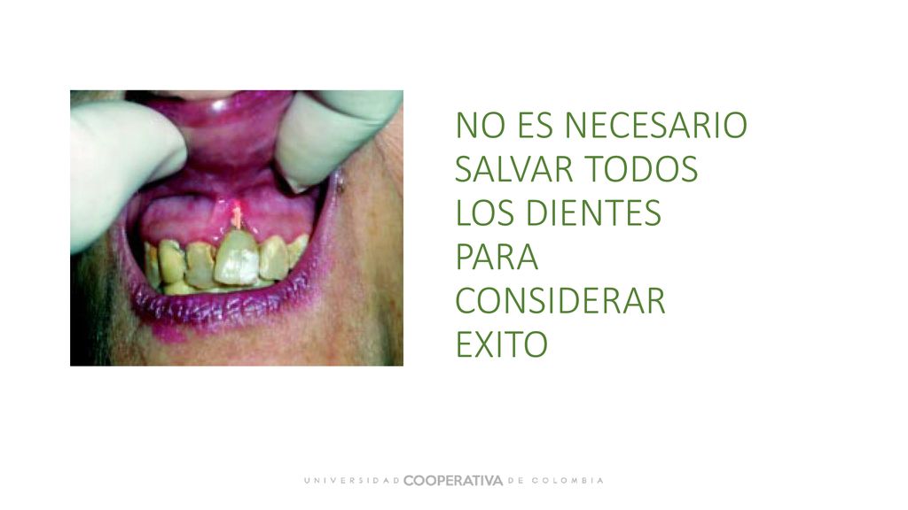 NO ES NECESARIO SALVAR TODOS LOS DIENTES PARA CONSIDERAR EXITO
