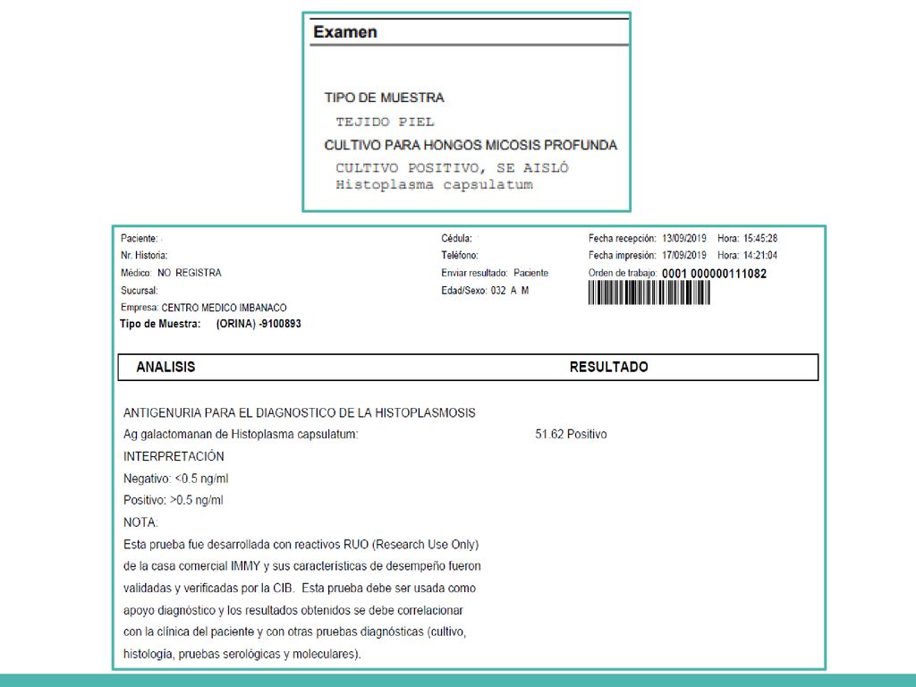 Se tomó el 10/09/19 Cultivo de piel también positivo para histoplasma.