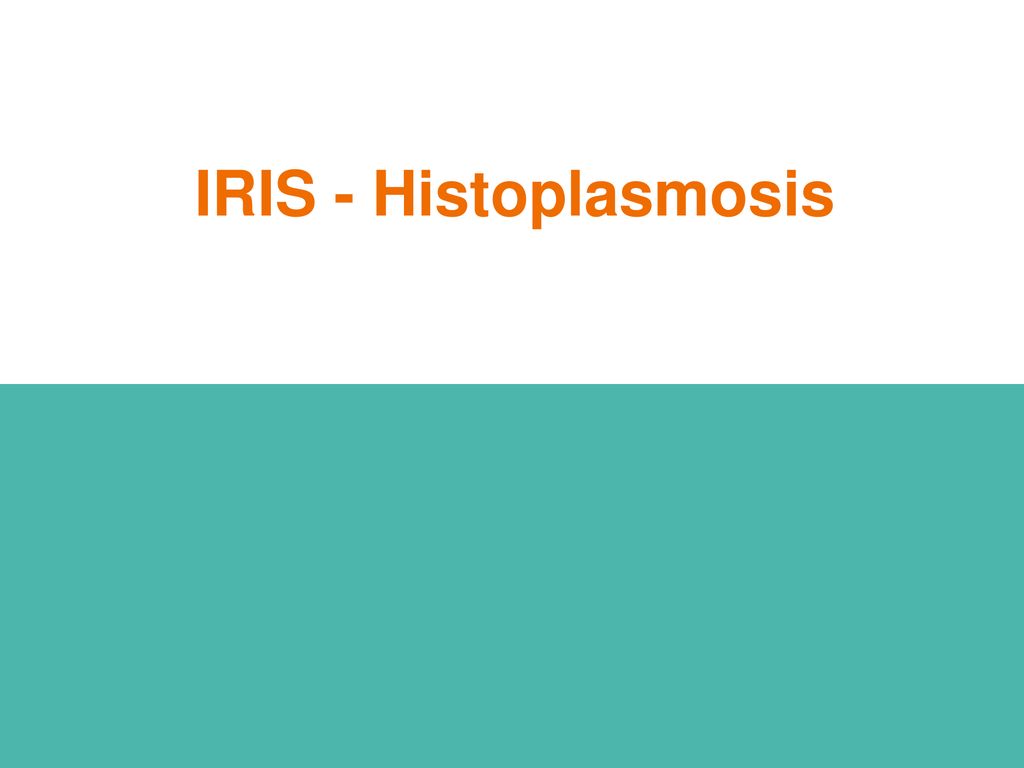 IRIS - Histoplasmosis Efecto de los antifúngicos en el desarrollo del síndrome de reconstitución inmune.