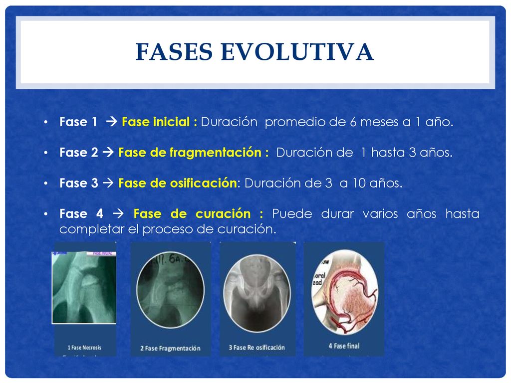 FASES EVOLUTIVA Fase 1  Fase inicial : Duración promedio de 6 meses a 1 año. Fase 2  Fase de fragmentación : Duración de 1 hasta 3 años.