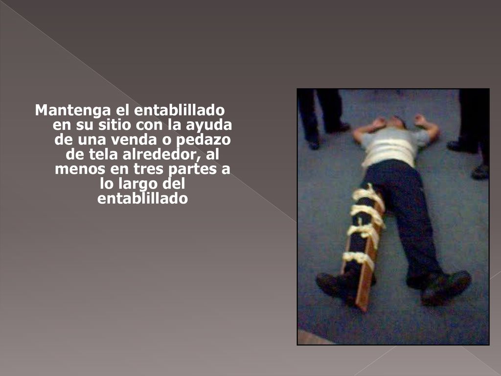 Mantenga el entablillado en su sitio con la ayuda de una venda o pedazo de tela alrededor, al menos en tres partes a lo largo del entablillado