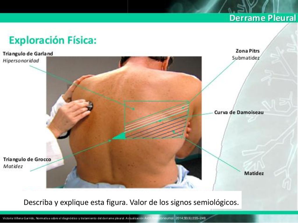 Describa y explique esta figura. Valor de los signos semiológicos.
