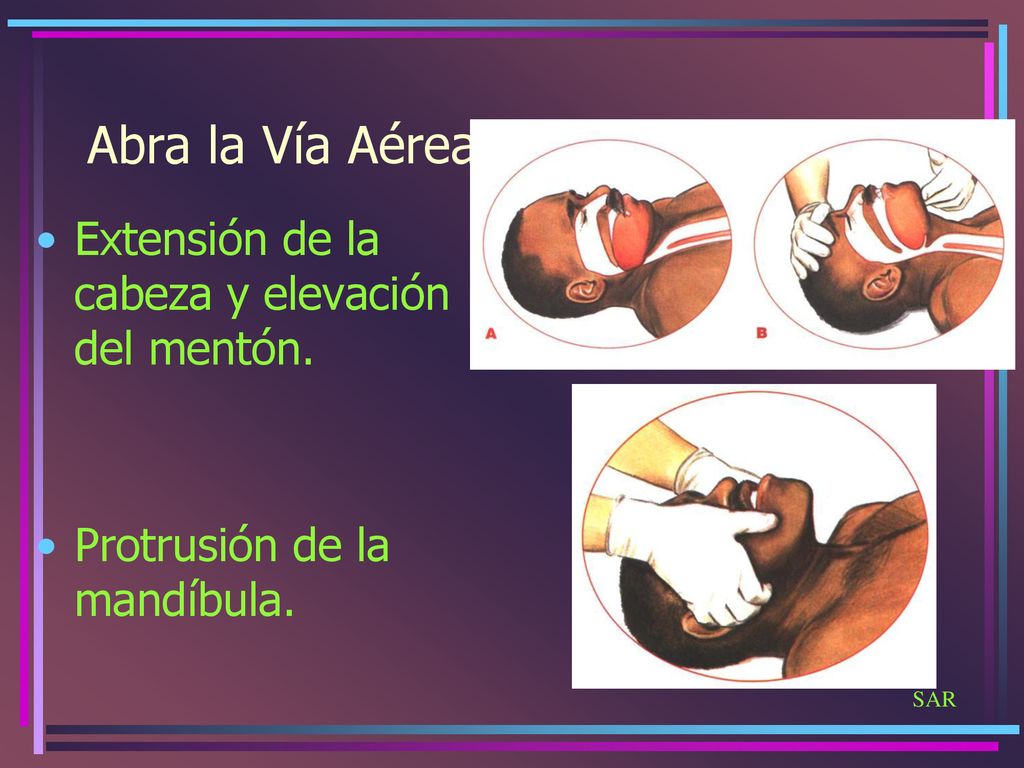 Abra la Vía Aérea Extensión de la cabeza y elevación del mentón.