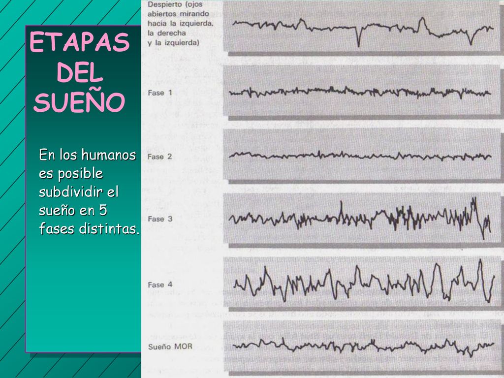 ETAPAS DEL SUEÑO En los humanos es posible subdividir el sueño en 5