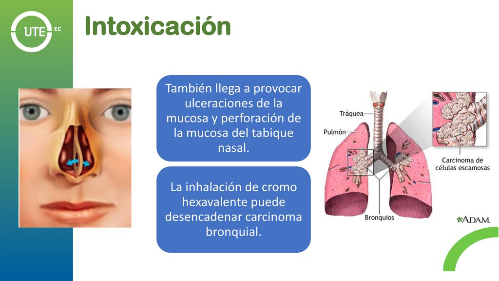 Intoxicación También llega a provocar ulceraciones de la mucosa y perforación de la mucosa del tabique nasal.