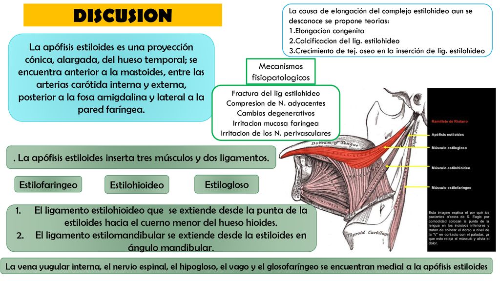 DISCUSION La causa de elongación del complejo estilohideo aun se desconoce se propone teorias: 1.Elongacion congenita.