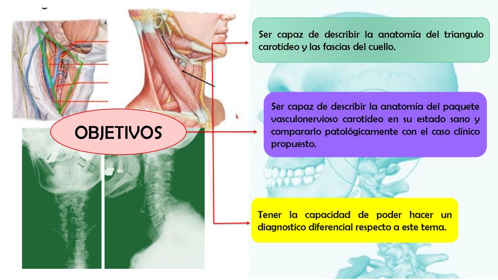 Ser capaz de describir la anatomía del triangulo carotideo y las fascias del cuello.