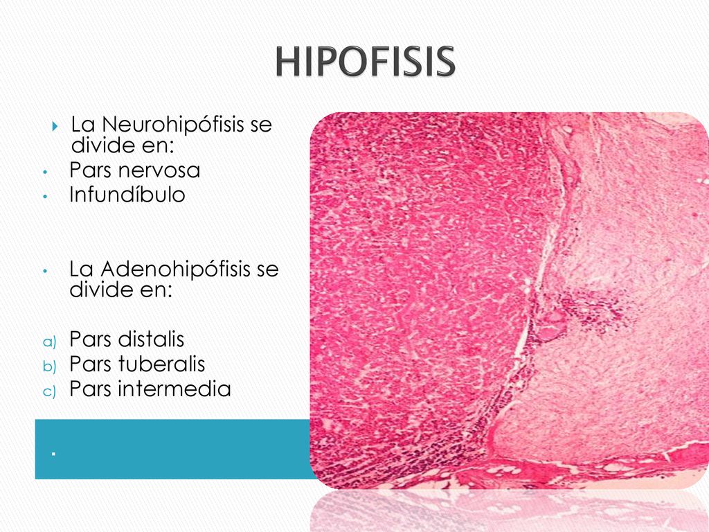 HIPOFISIS . La Neurohipófisis se divide en: Pars nervosa Infundíbulo