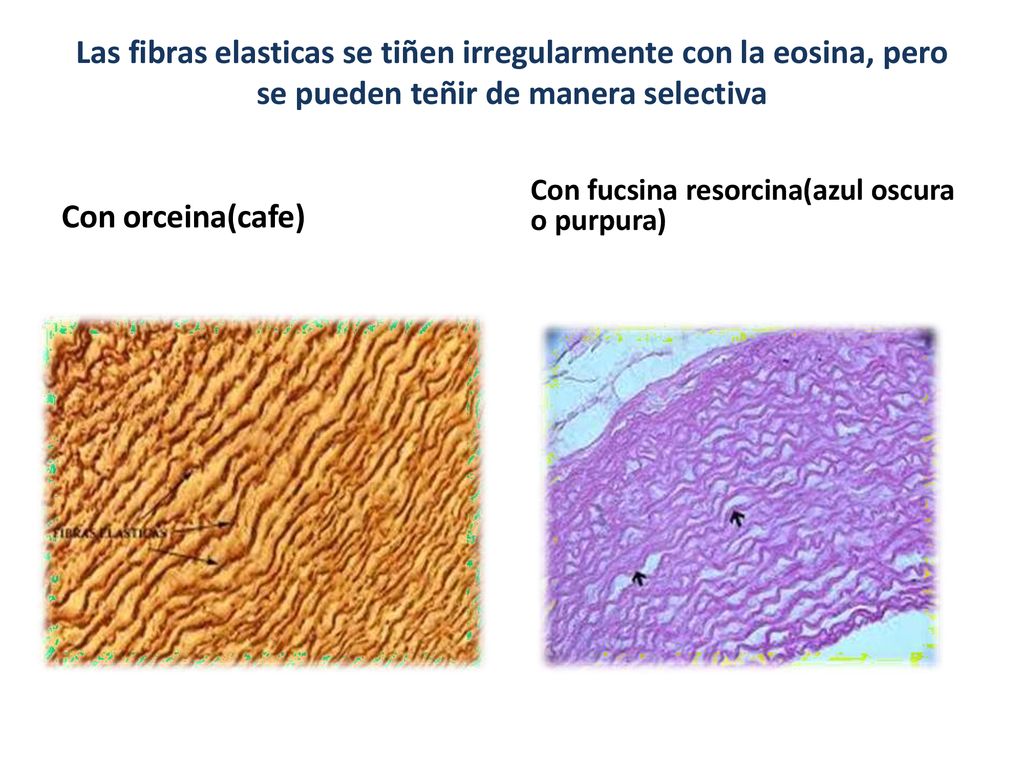 Las fibras elasticas se tiñen irregularmente con la eosina, pero