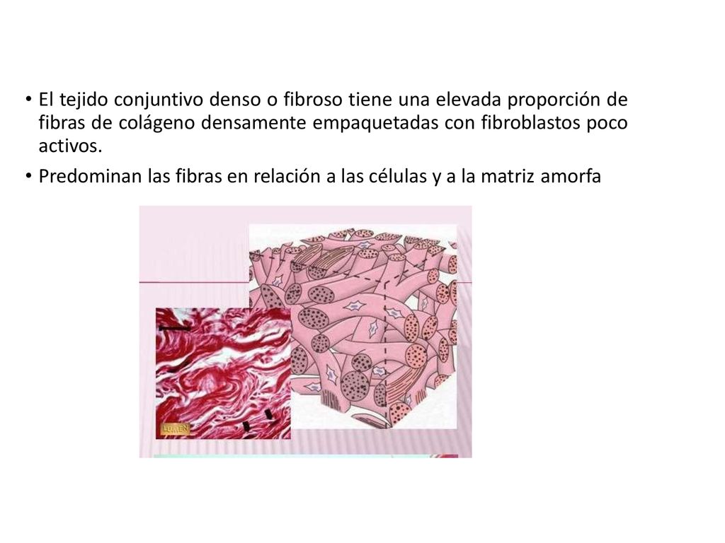 El tejido conjuntivo denso o fibroso tiene una elevada proporción de fibras de colágeno densamente empaquetadas con fibroblastos poco activos.