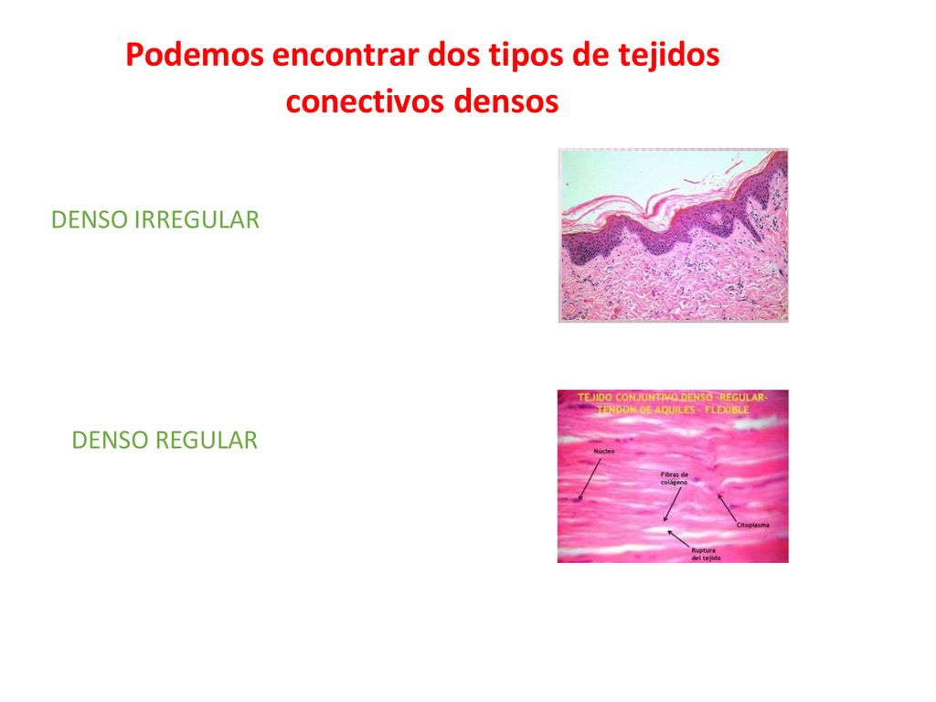 Podemos encontrar dos tipos de tejidos conectivos densos