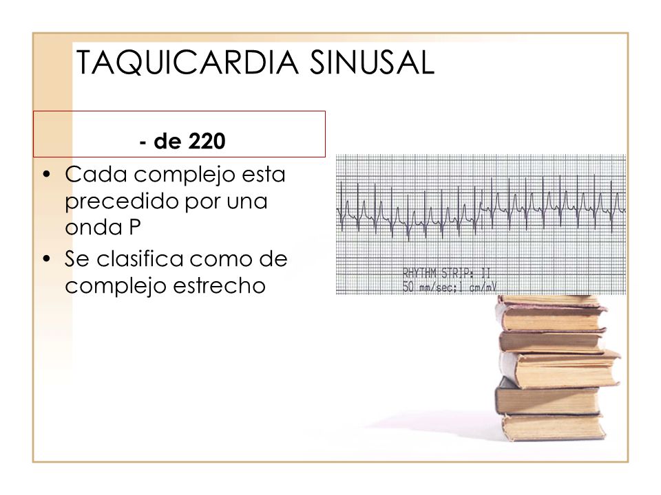 TAQUICARDIA SINUSAL - de 220
