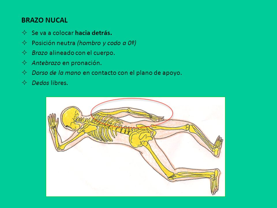 BRAZO NUCAL Se va a colocar hacia detrás.