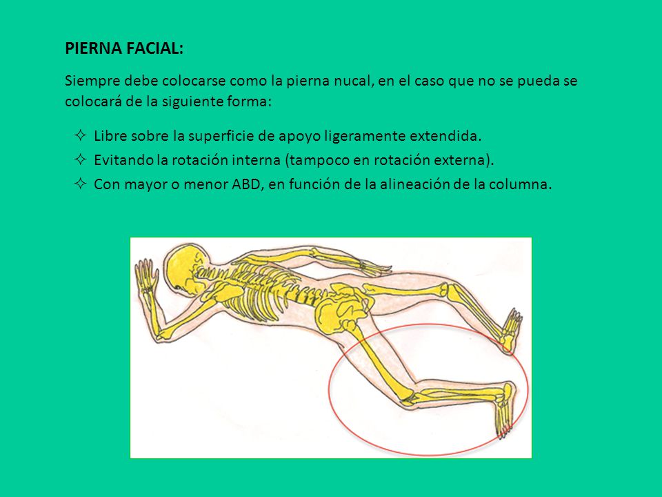 PIERNA FACIAL: Siempre debe colocarse como la pierna nucal, en el caso que no se pueda se colocará de la siguiente forma: