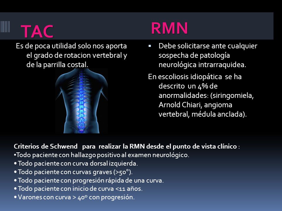 TAC RMN. Es de poca utilidad solo nos aporta el grado de rotacion vertebral y de la parrilla costal.