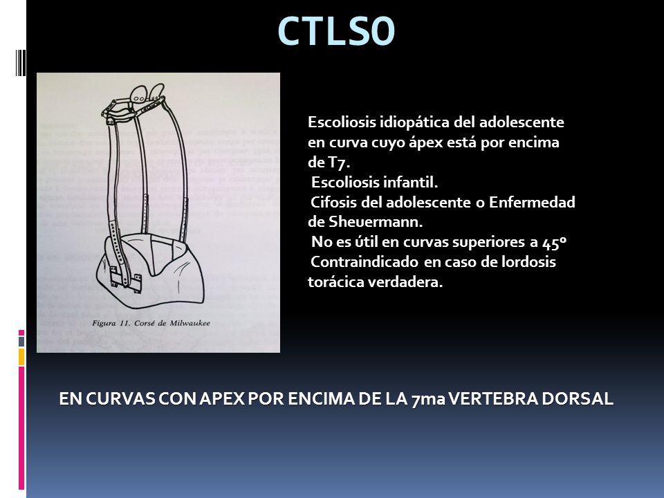 CTLSO EN CURVAS CON APEX POR ENCIMA DE LA 7ma VERTEBRA DORSAL