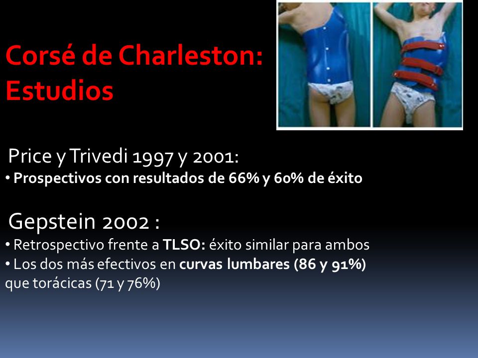 Corsé de Charleston: Estudios Price y Trivedi 1997 y 2001: