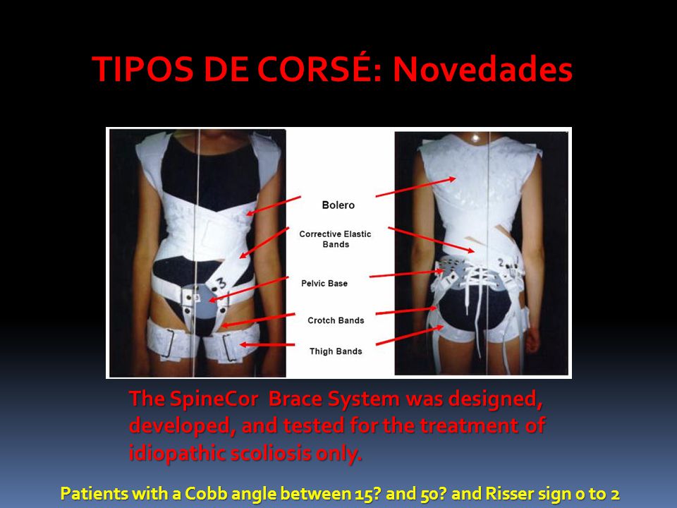 TIPOS DE CORSÉ: Novedades