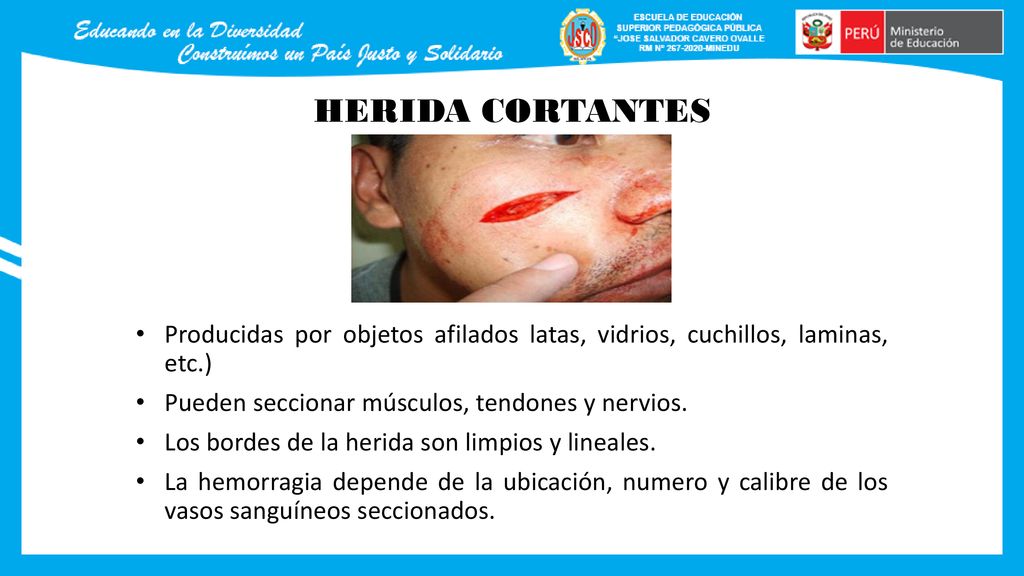 HERIDA CORTANTES Producidas por objetos afilados latas, vidrios, cuchillos, laminas, etc.) Pueden seccionar músculos, tendones y nervios.