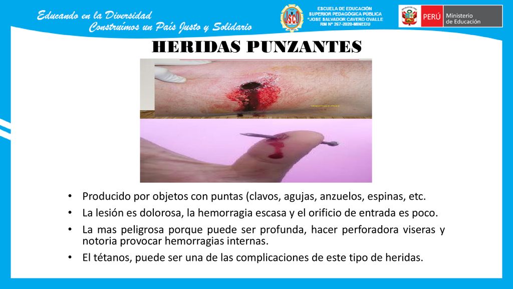 HERIDAS PUNZANTES Producido por objetos con puntas (clavos, agujas, anzuelos, espinas, etc.