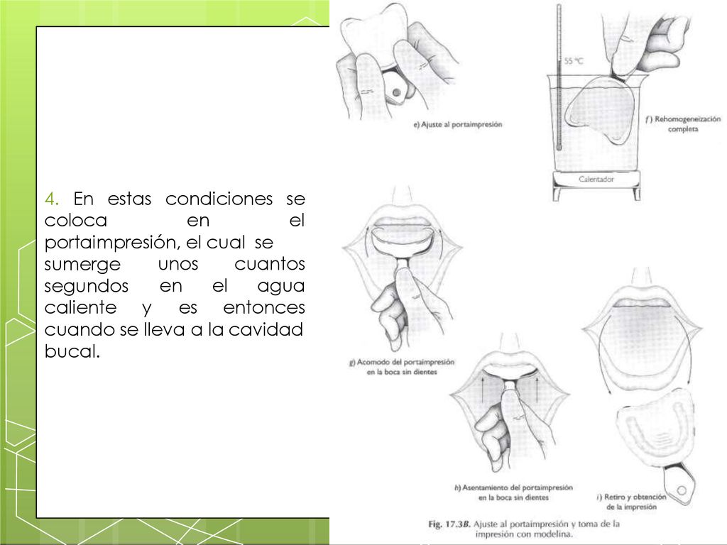 4. En estas condiciones se coloca en el portaimpresión, el cual se