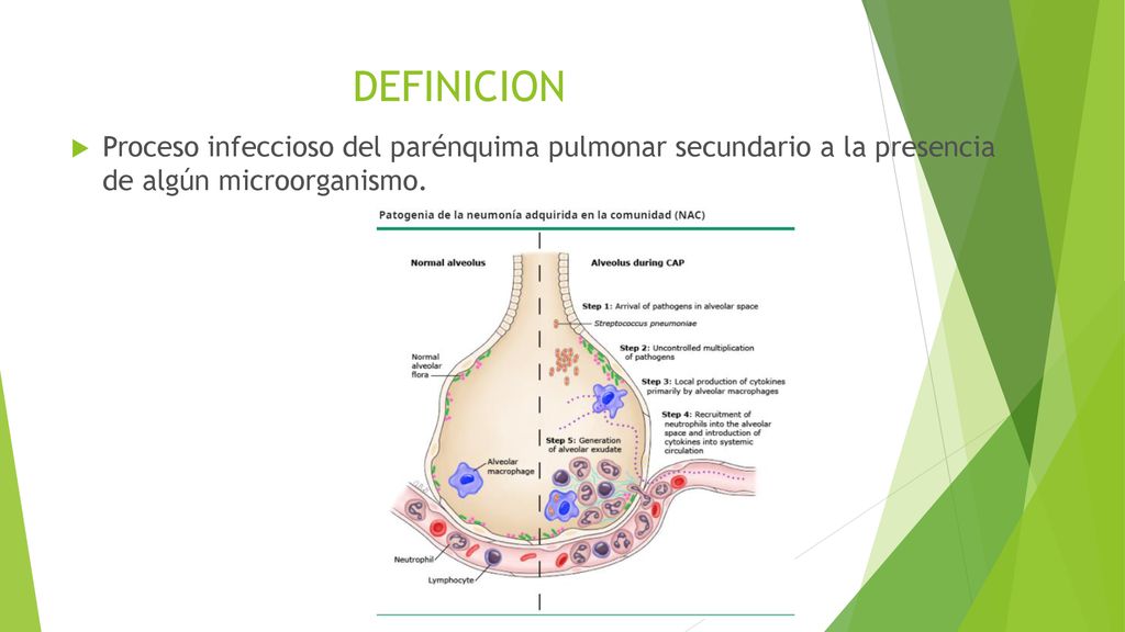 DEFINICION Proceso infeccioso del parénquima pulmonar secundario a la presencia de algún microorganismo.