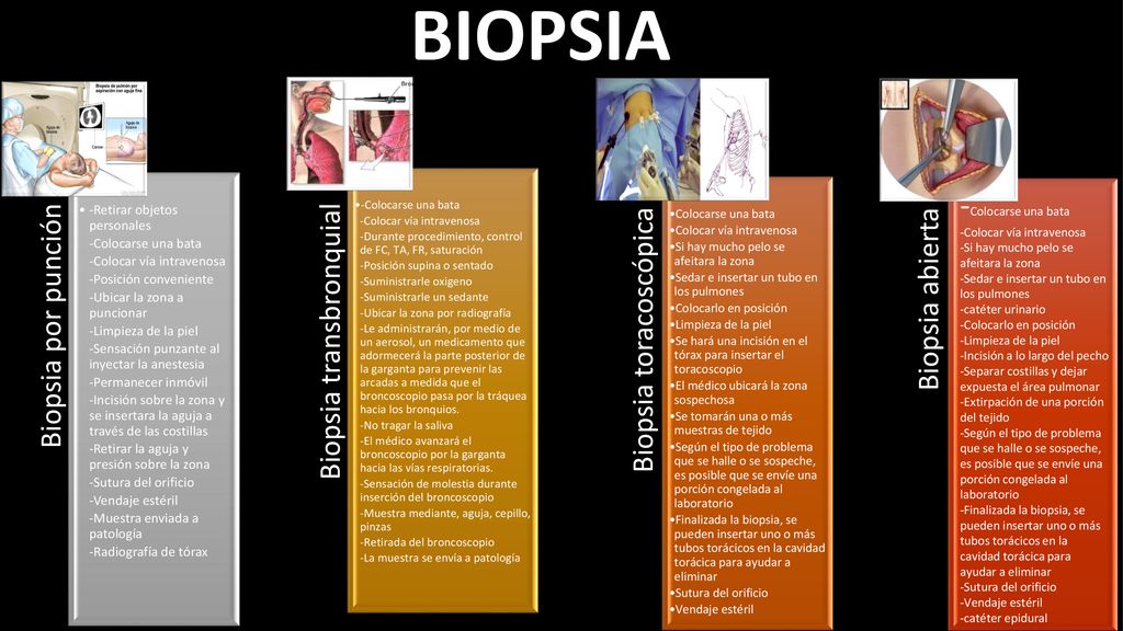 BIOPSIA -Colocarse una bata Biopsia por punción Biopsia transbronquial