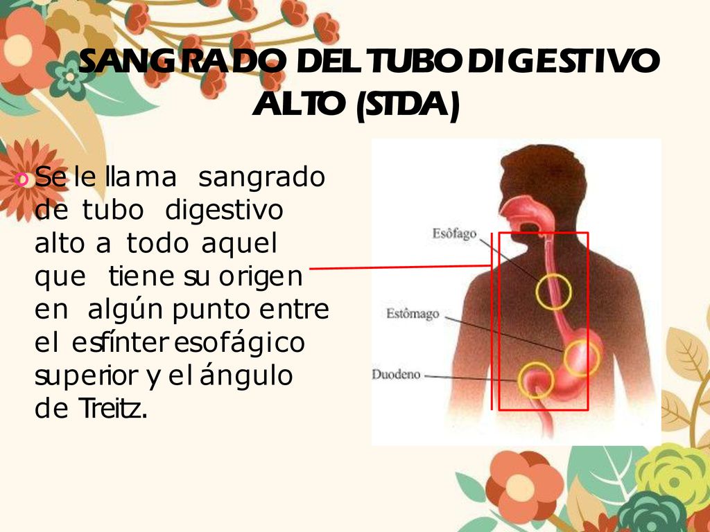 SANGRADO DEL TUBO D I GES T I V O ALTO (STDA)