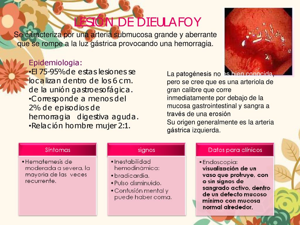 LESIÓN DE DIEULAFOY Se caracteriza por una arteria submucosa grande y aberrante que se rompe a la luz gástrica provocando una hemorragia.