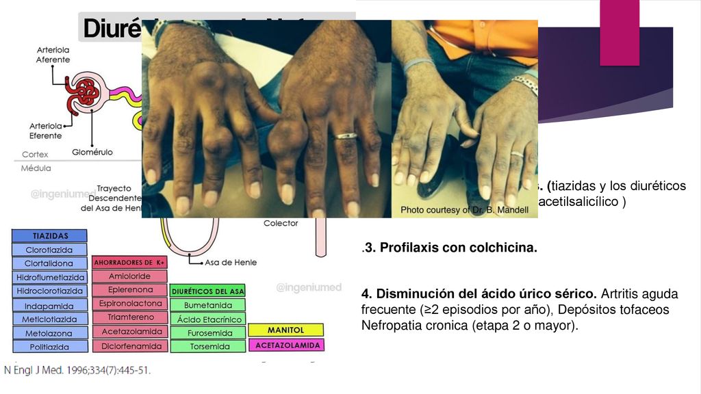 1. Dieta. 2. fármacos hiperuricémicos. (tiazidas y los diuréticos de asa inhiben, niacina, acido acetilsalicílico )