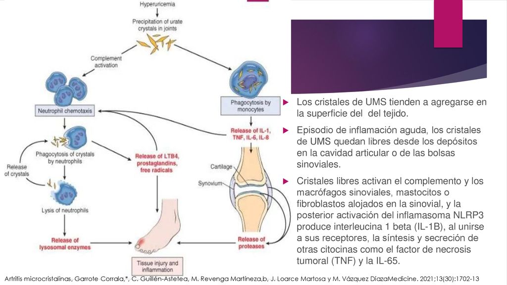 Los cristales de UMS tienden a agregarse en la superficie del del tejido.