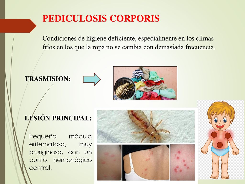 PEDICULOSIS CORPORIS Condiciones de higiene deficiente, especialmente en los climas fríos en los que la ropa no se cambia con demasiada frecuencia.