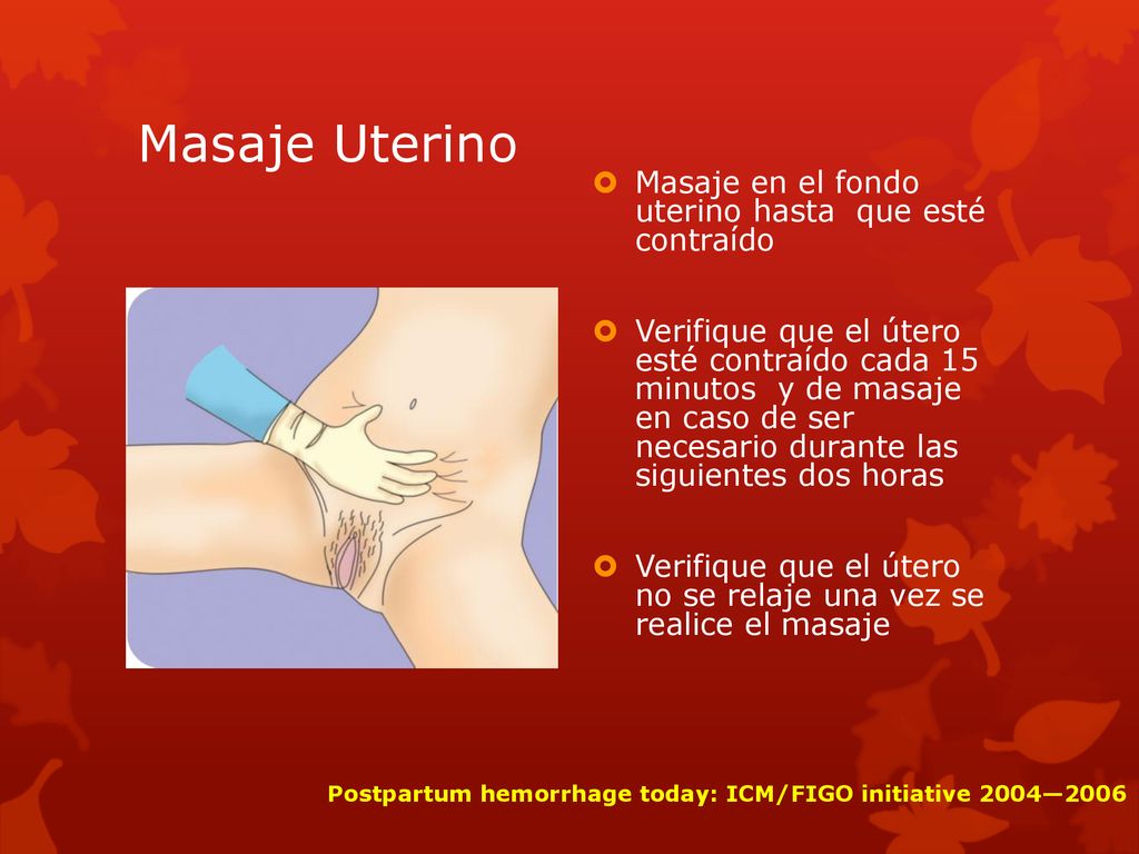 Masaje Uterino Masaje en el fondo uterino hasta que esté contraído