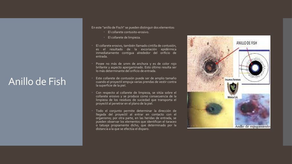 En este anillo de Fisch se pueden distinguir dos elementos: