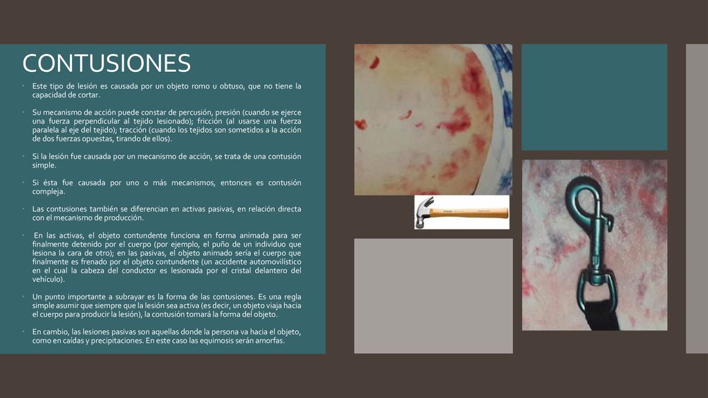 CONTUSIONES Este tipo de lesión es causada por un objeto romo u obtuso, que no tiene la capacidad de cortar.