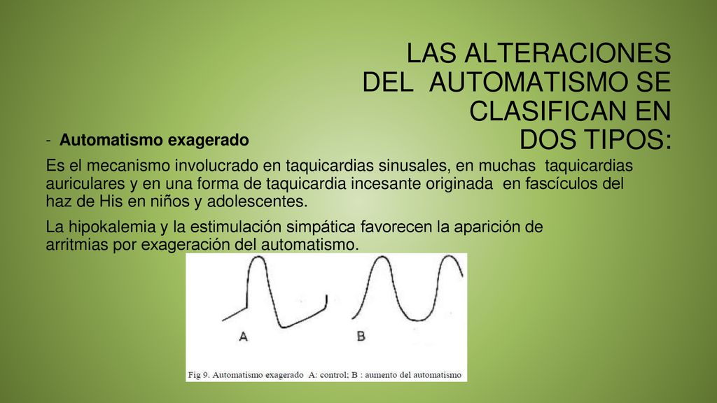 LAS ALTERACIONES DEL AUTOMATISMO SE CLASIFICAN EN DOS TIPOS: