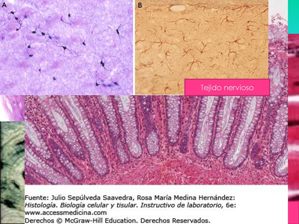 Cartílago Epitelio glandular Tejido nervioso Epitelio de la piel Músculo estriado Hueso